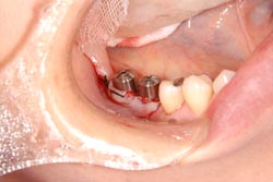 �C���v�����g�ʐ^02