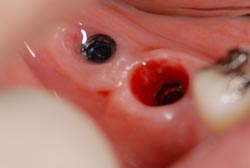 �C���v�����g�ʐ^03