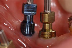 �C���v�����g�ʐ^04