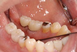 �C���v�����g�ʐ^06