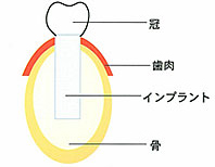 ���o�C���v�����g